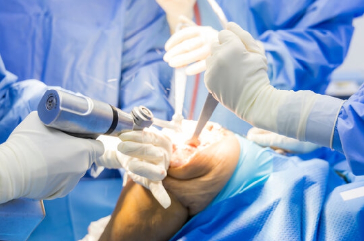 Joint-Replacement-15